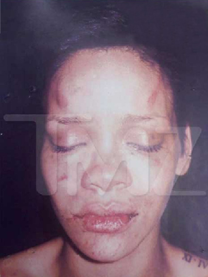 Rihanna Beating Picture via TMZ